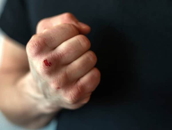 A bloody fist.